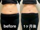 ヨサパーク プラム(YOSA PARK Plum)の写真/【痩身×温活】進化系よもぎ蒸し＋深部リンパマッサージで理想の身体に！芯から身体を温めて脂肪燃焼！