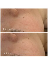 メナードフェイシャルサロン 岐阜茜部/UVケア/ホワイトニング