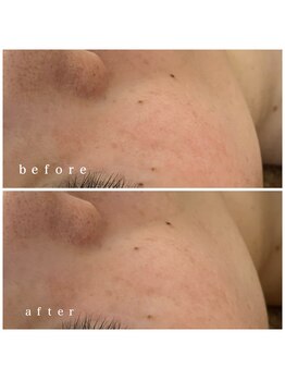 メナードフェイシャルサロン 岐阜茜部/UVケア/ホワイトニング