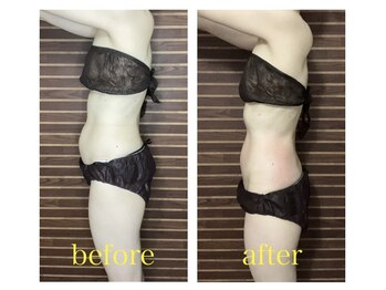 愛 まぁる/不調改善しながら痩身効果大◎