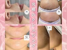ホワイトワックス 新潟万代店(WHITE WAX)の雰囲気（メンズにも大人気◎太いヒゲも根本からごっそり！美肌男子♪）