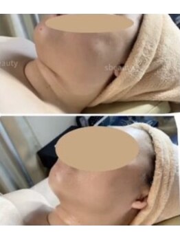 エスビューティー 三軒茶屋(S beauty)/バストケア・世田谷・痩身