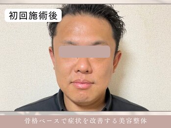 ほぐし屋 かすがい/初回/小顔リフト+美姿勢整体