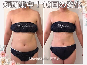 マリスステラ 天王寺(MarisStella)/短期間で上半身に変化！