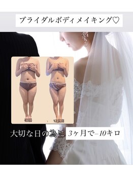 エステサロン ジュブリー/ブライダル痩身