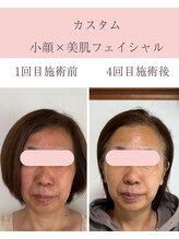 シンナリ(Shinnari)/カスタム小顔×美肌フェイシャル