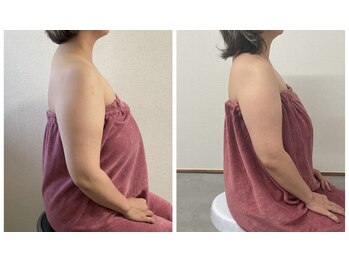 ブリランテ(Brillante)/