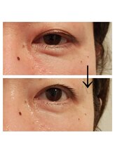 エステサロン カラーズ(COLORS)/目元のたるみお任せ