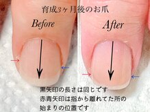 トゥインクリーネイルサロン(Twinkly Nail Salon)/【地爪育成】1回お試し