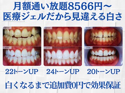 スマイルホワイト 赤羽店の写真