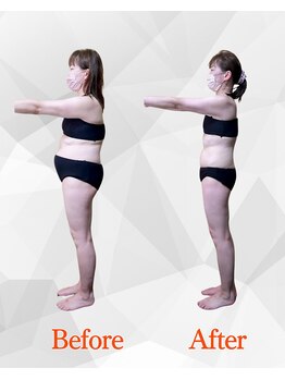 ビジュクイーン(BIJOU QUEEN)/５０代・１５キロダイエット成功