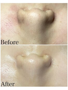 ブラックボックス(BLACK BOX)/20代女性のお客様