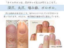 アクア(AKuA)の雰囲気（爪のお悩み改善サロン/自爪育成の専門家在籍）
