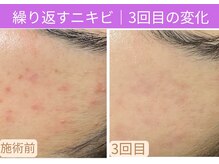 おうちサロン ミキ