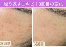おうちサロン ミキ