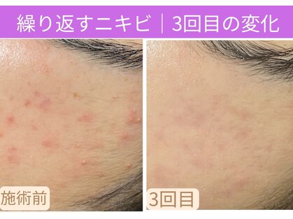 おうちサロン ミキの写真