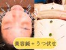 【美容鍼リフトUP！＋鍼灸(うつ伏せ)】平日は500円OFF!!