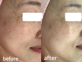 サクラ 本厚木駅前店(SAKURA)/本厚木シミケア/伊勢店シミケア