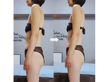 ブラグ(BRAG)の写真