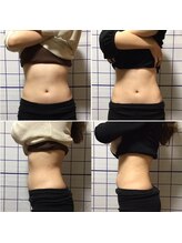 アリス フィットネスサロン/＊ウエスト施術効果＊