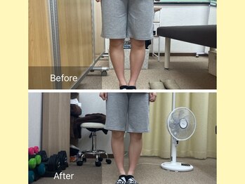 ナオル整体 春日部院(NAORU整体)/O脚改善