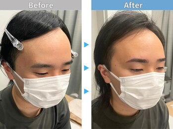 マユクリア 埼玉大宮店/美眉B/A [眉毛/眉毛サロン/大宮]