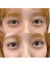 ルイール 光の森(Luire)/まつ毛パーマ/ラッシュリフト