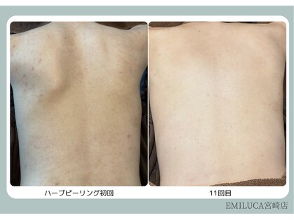 エミルカ 宮崎店(EMILUCA)の写真