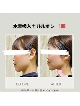 ヨサパーク ケイアンドリー(YOSA PARK)/ハイディーナ×ルルオン