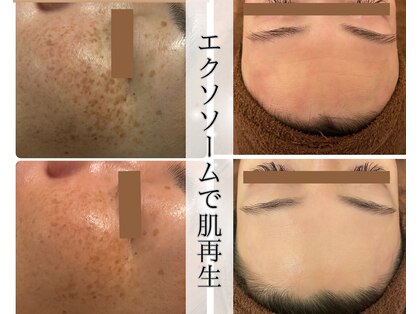 ラ セルフィー(Ra Selfee)の写真