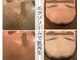 ラ セルフィー(Ra Selfee)の写真
