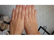 ベルタ(Relaxation&Nail Room BELTA)/ハンドスパケア