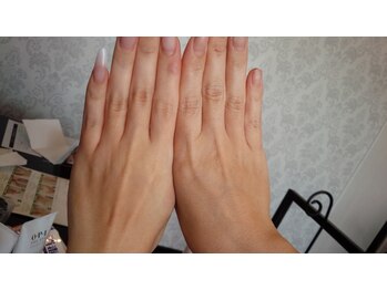 ハンドスパケア