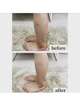 パルボヌール(parbonheur)/マッサージでここまで変わる!