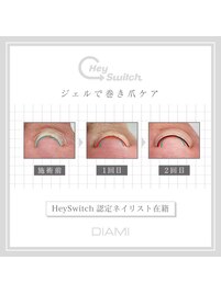 Hey Switch (巻き爪ケアジェル)