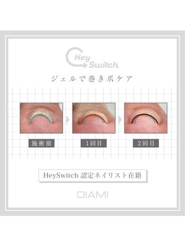 ルアマナ(Luamana)/Hey Switch (巻き爪ケアジェル)