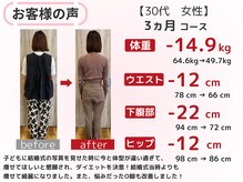スロース鍼灸整体院(SLOTH鍼灸整体院)/30代 3ヵ月ダイエット(痩身)成果