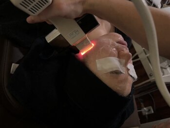 ビューティコア 二子玉川/毛穴/小顔/ニキビ/シミ