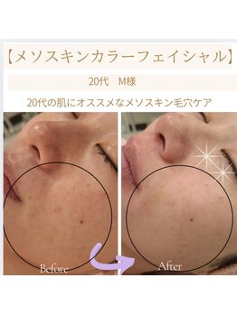 マールム(MALUM)/20代のノーファンデ肌　