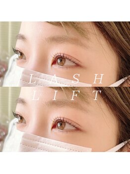 アール(R)/ラッシュリスト