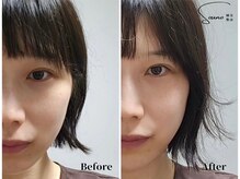 ソウノ 御茶ノ水(Souno)/お客様ビフォー・アフター