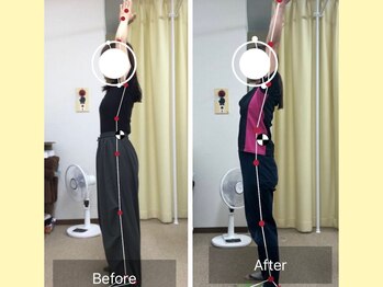 ナオル整体 春日部院(NAORU整体)/肩周りスムーズに動く!