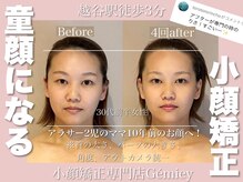 ジェイミー(Gemiey)/アラサーママ、独身時代のお顔へ