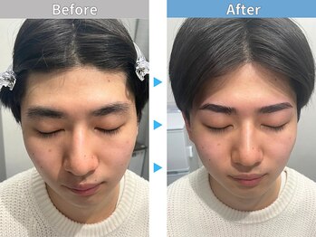 マユクリア 埼玉大宮店/美眉B/A [眉毛/眉毛サロン/大宮]