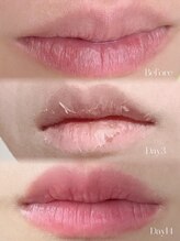 ワックスラボ(WAXLAB)/メラニンケア☆