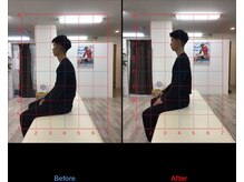 ストレチックス 近江八幡店/BeforeAfter