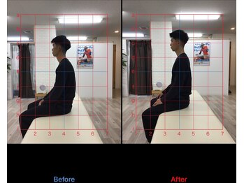 ストレチックス 近江八幡店/BeforeAfter