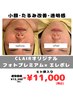 【人気No.2】美肌フォト×美容液導入¥13,200→¥11,000【たるみ改善コース】