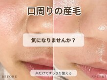 ビビ(BiBi)/口周りの産毛
