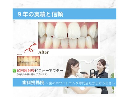ホワイトニングショップ 西原店の写真